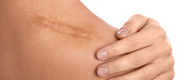 HOW TO HEAL YOUR SCARS