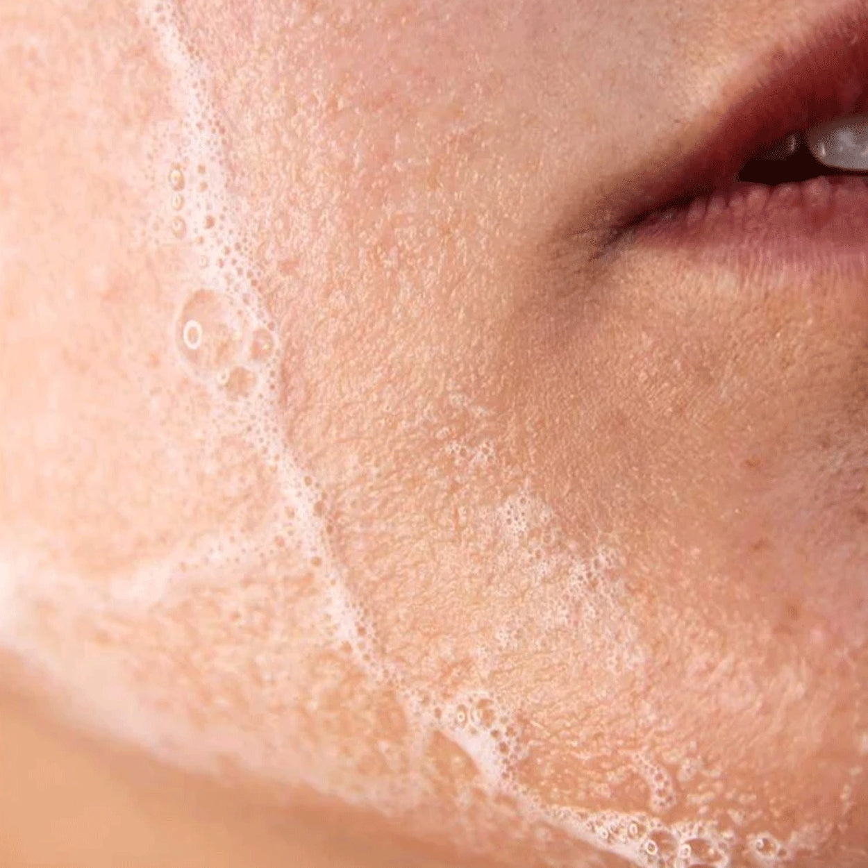 ARCHIVED Advanced Lauric Acid Cleanser Model Image