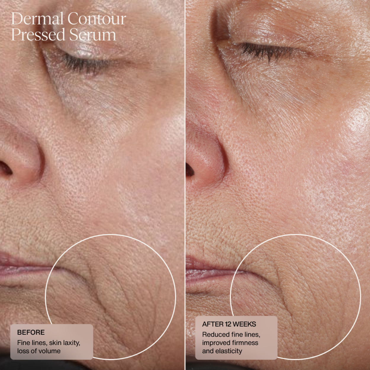 HydraFirm (Dermal Contour Pressed Serum)