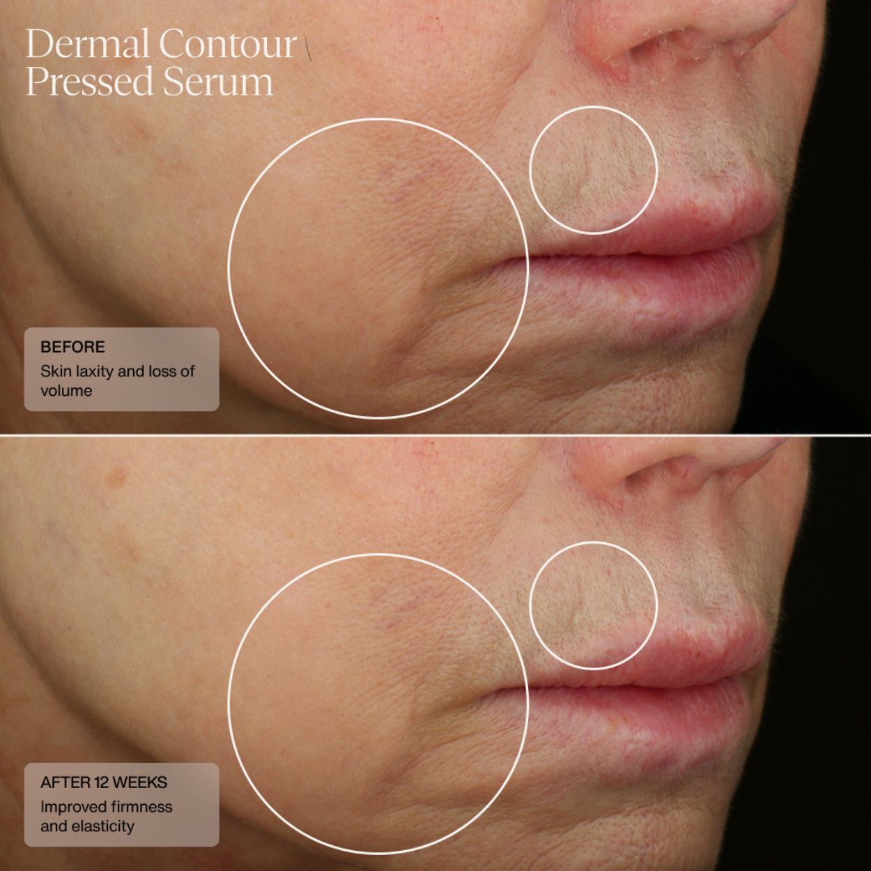 HydraFirm (Dermal Contour Pressed Serum)