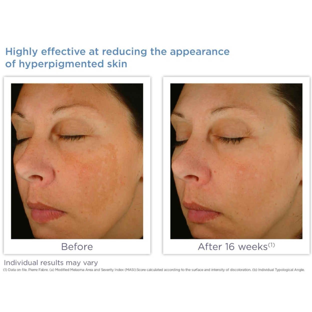 Enhance Brightening Complex Image 4
