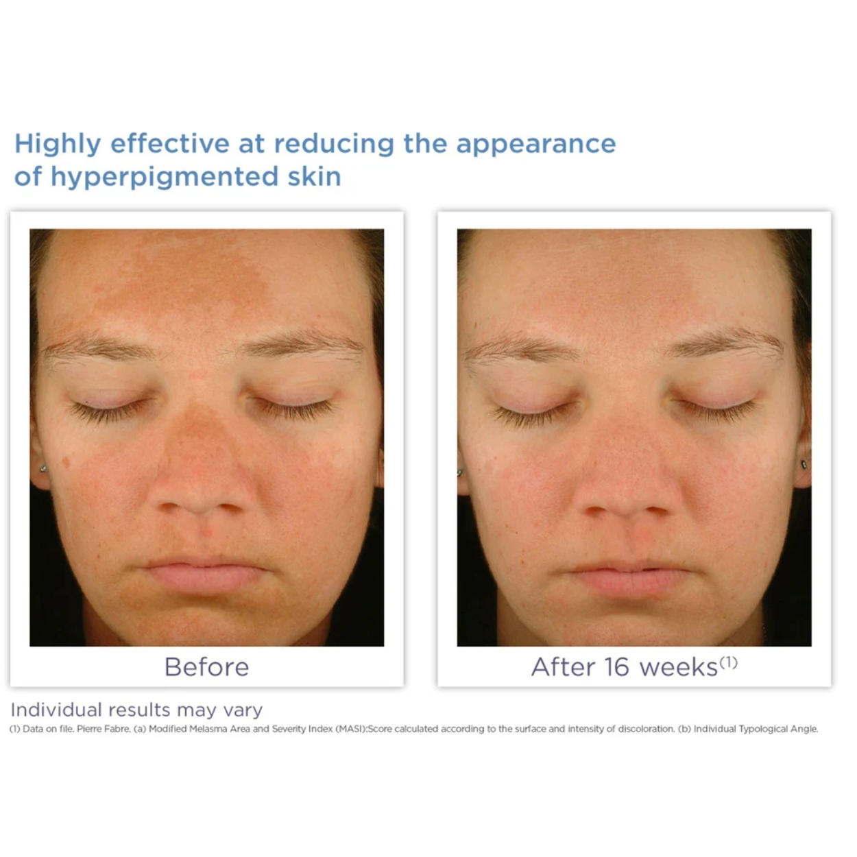 Enhance Brightening Complex Image 5