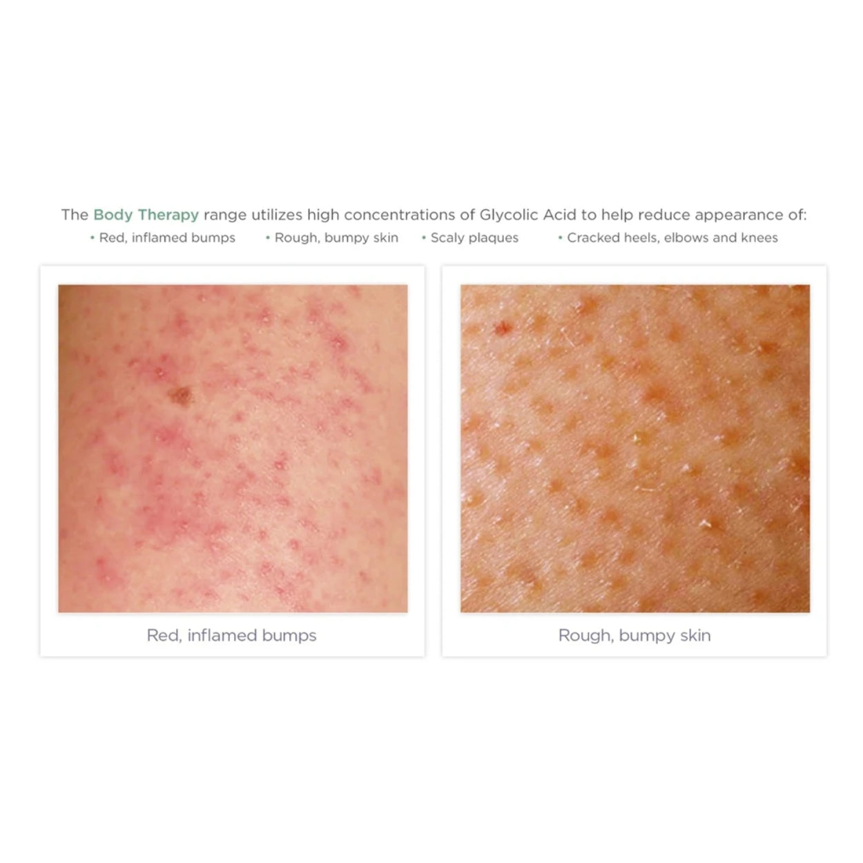 Exfoliating Body Wash features Image 1
