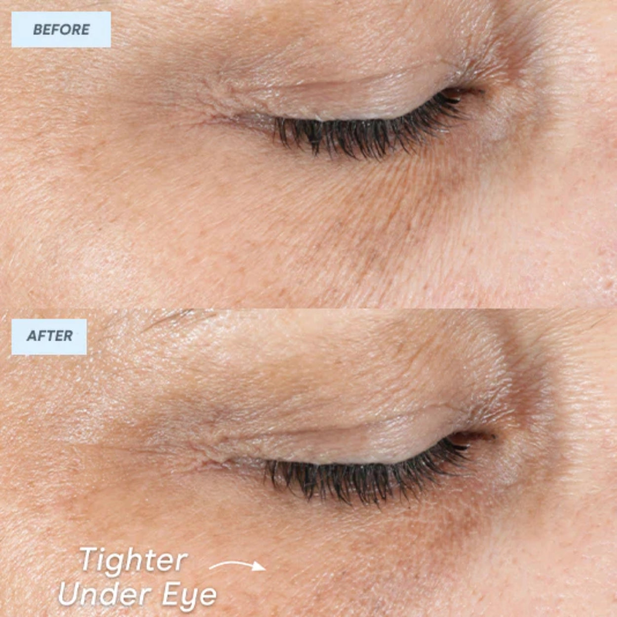 FIX MicroWand Hero Model Image 3