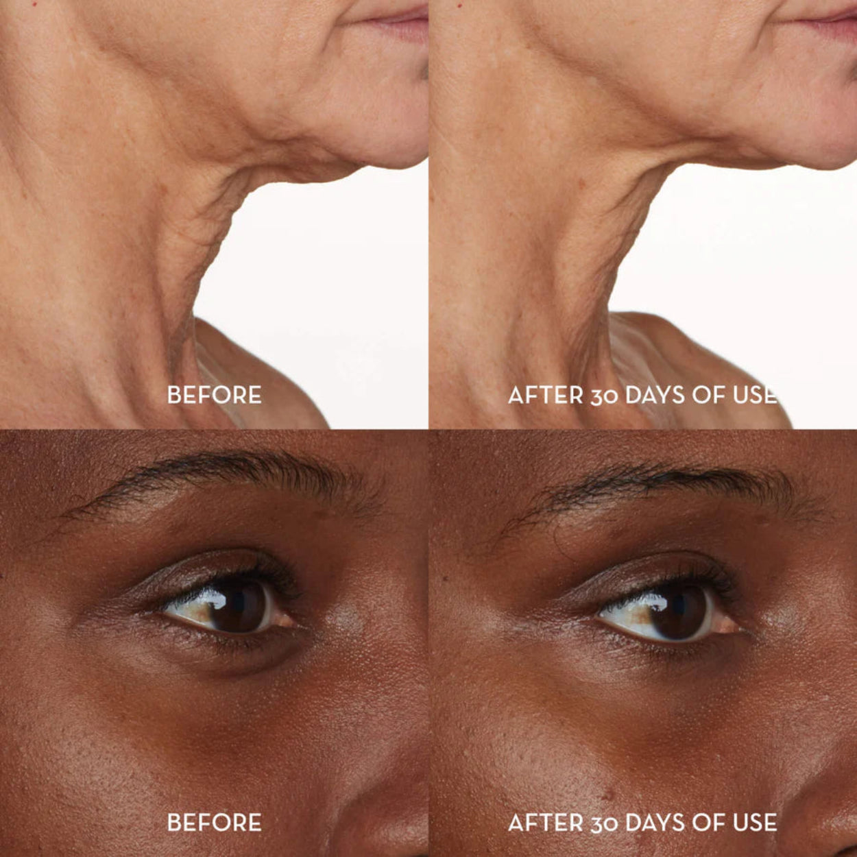 FurtunaSkinPortePerLaVitalitaFace_EyeSerumResults