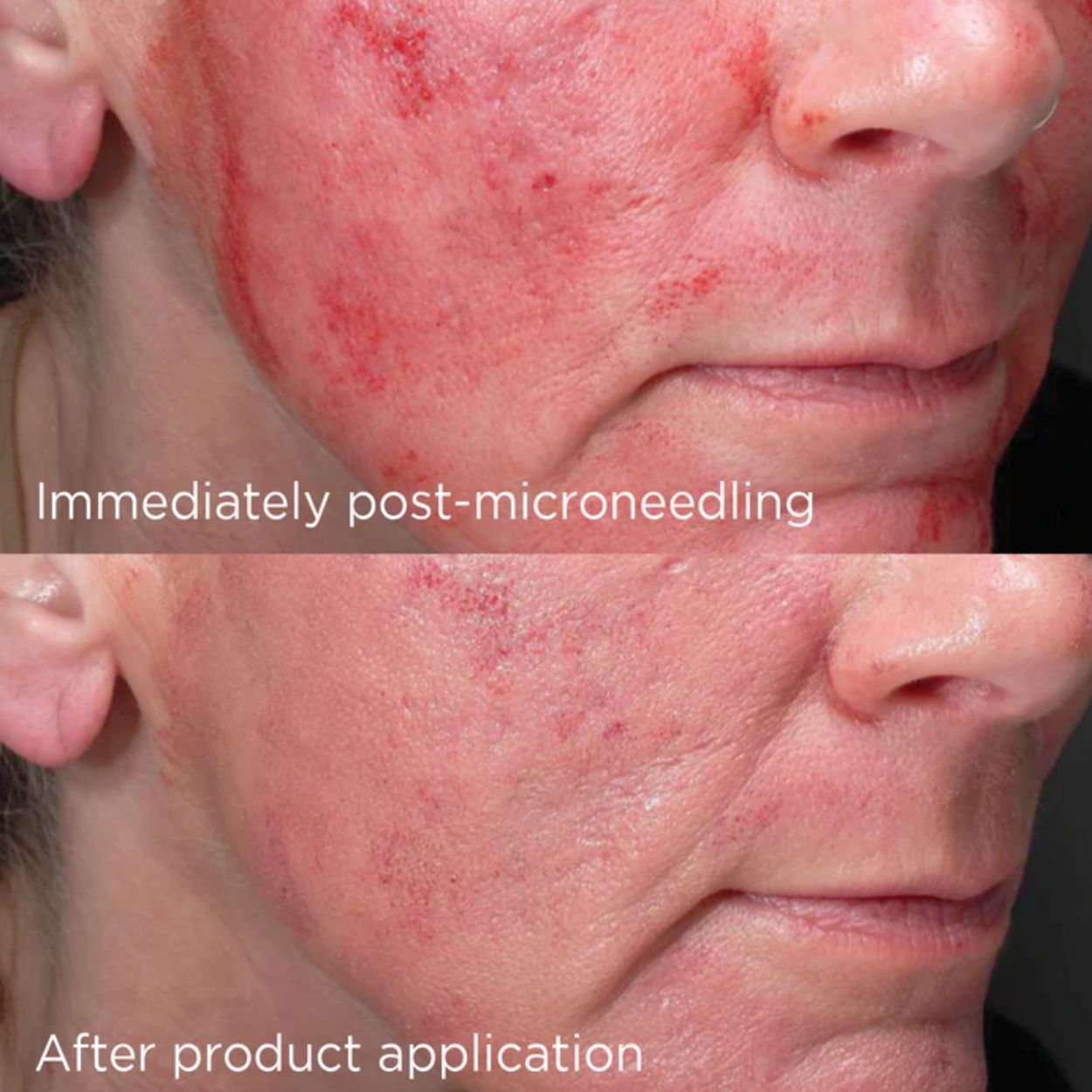 IMAGE Daily Prevention Advanced Smartblend Mineral Moisturizer SPF 75 Post Procedure