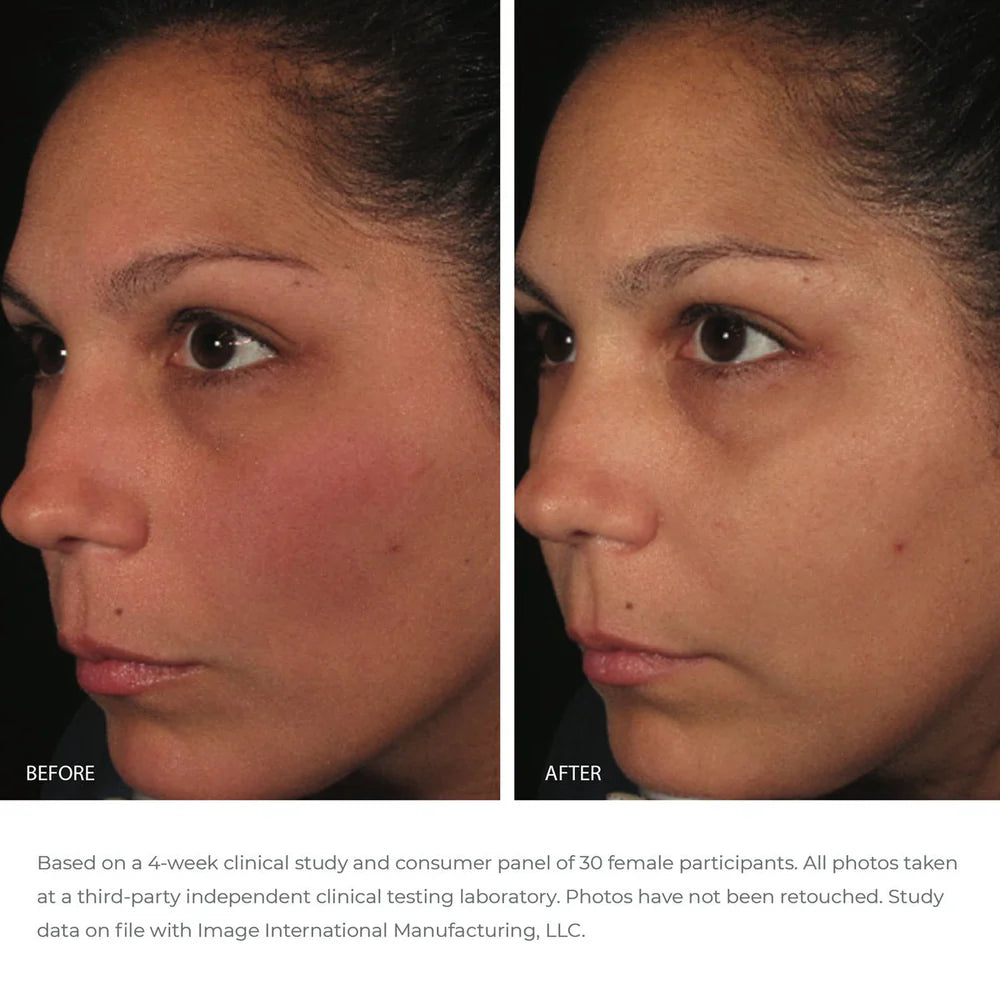 IMAGE Ormedic Balancing Antioxidant Serum Results