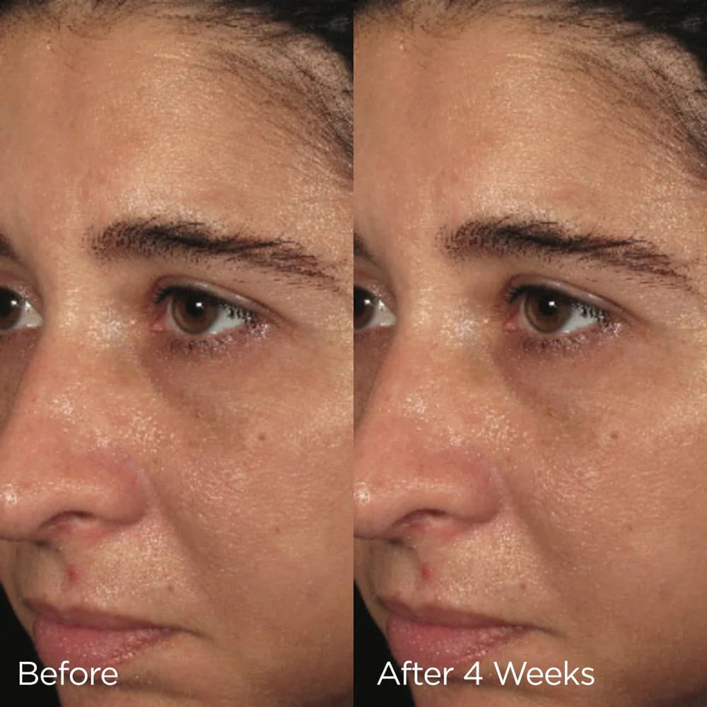 Ormedic Balancing Biopeptide Crème Clinical Results