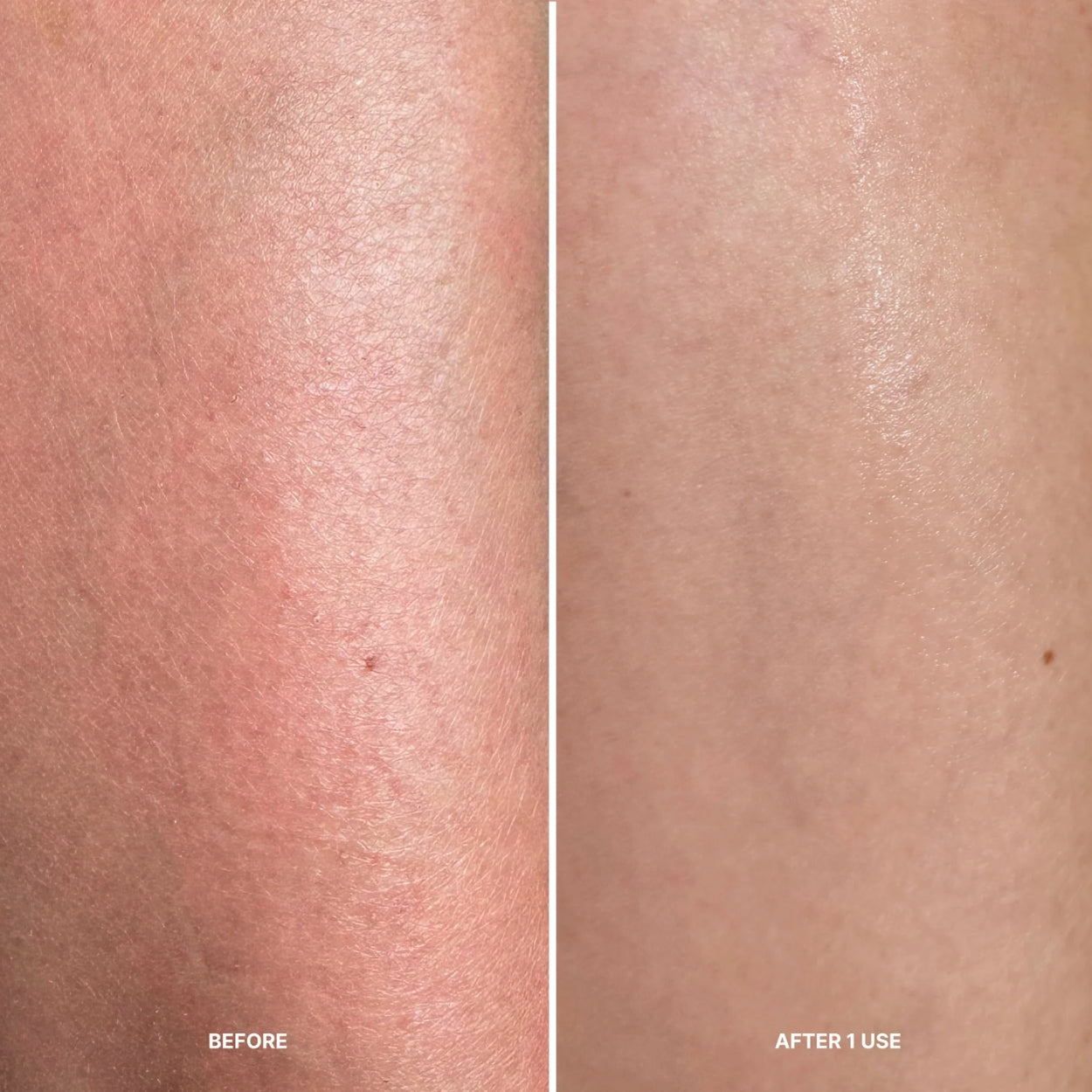 Instant Peel Fragrance Free Before After Image