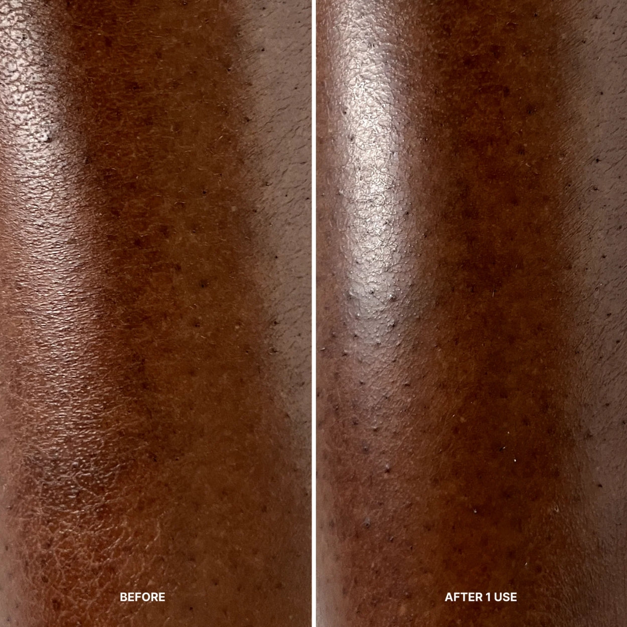 Instant Peel Slow Blink Before After Image