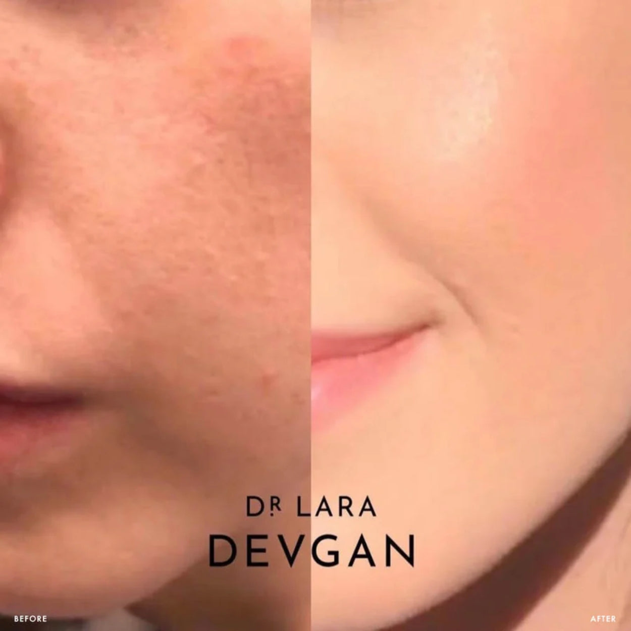 Microdermabrasion Scrub Model Image 1