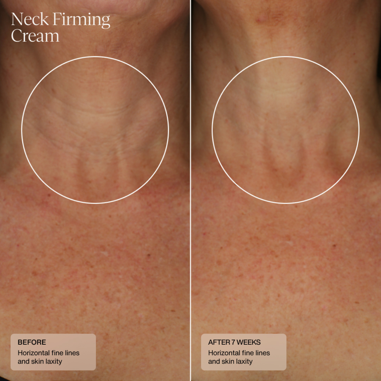 Neck Firming Cream