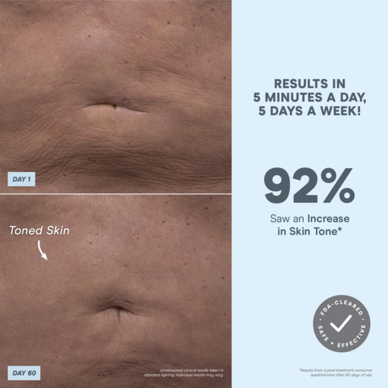 NuBODY Body Toning Device 5