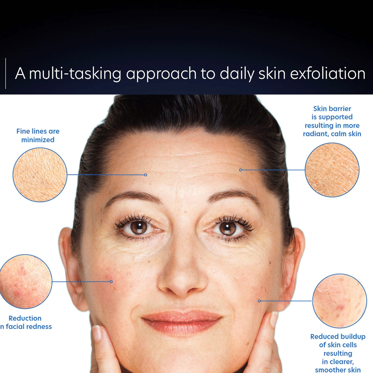 PCA Skin Resurfacing Serum