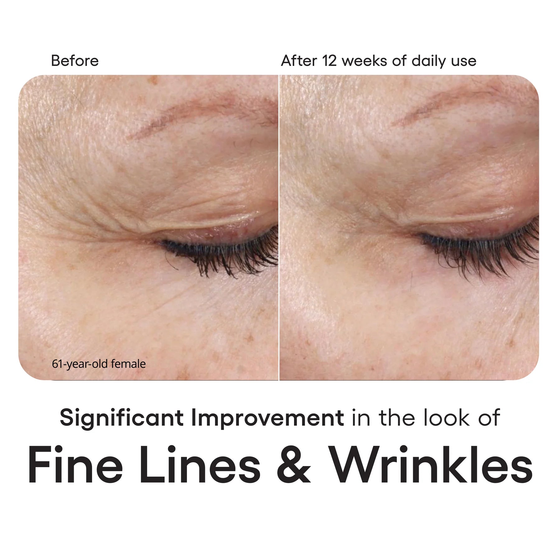 Plated Skin Science Intense Serum Refil