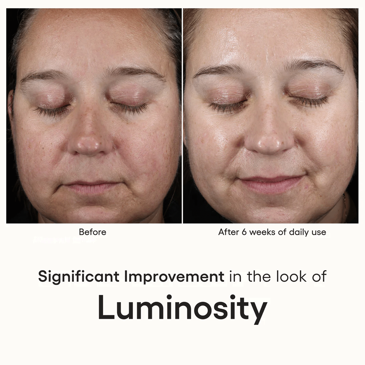 Plated Skin Science Intense Serum Clinical Results