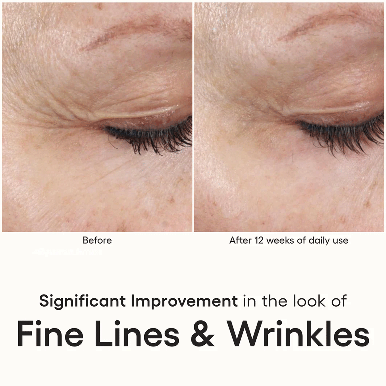 Plated Skin Science Intense Serum Clinical Results 1