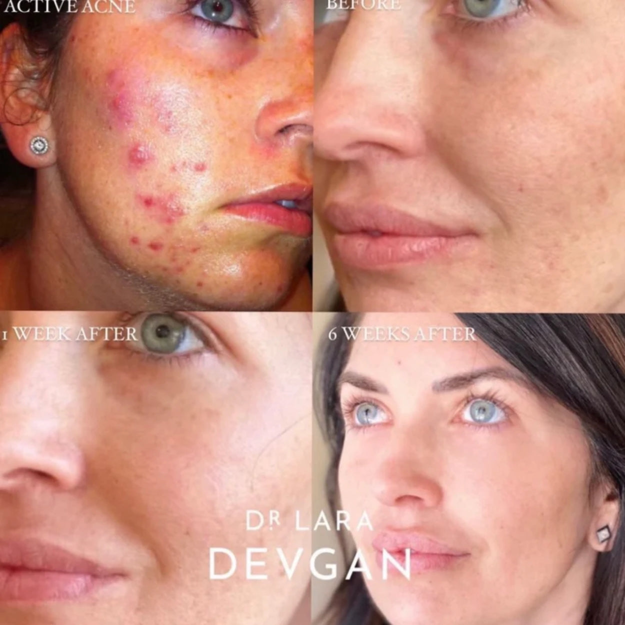 Retinal Bakuchiol Serum Model Image 3