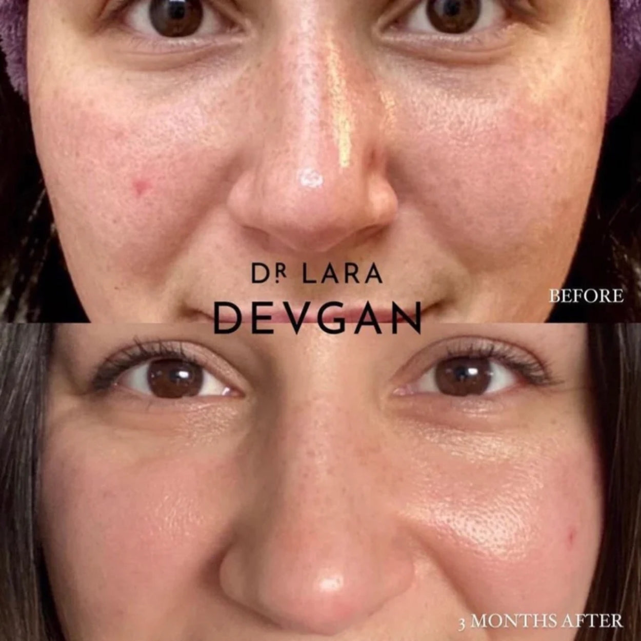 Retinal Bakuchiol Serum Model Image 4