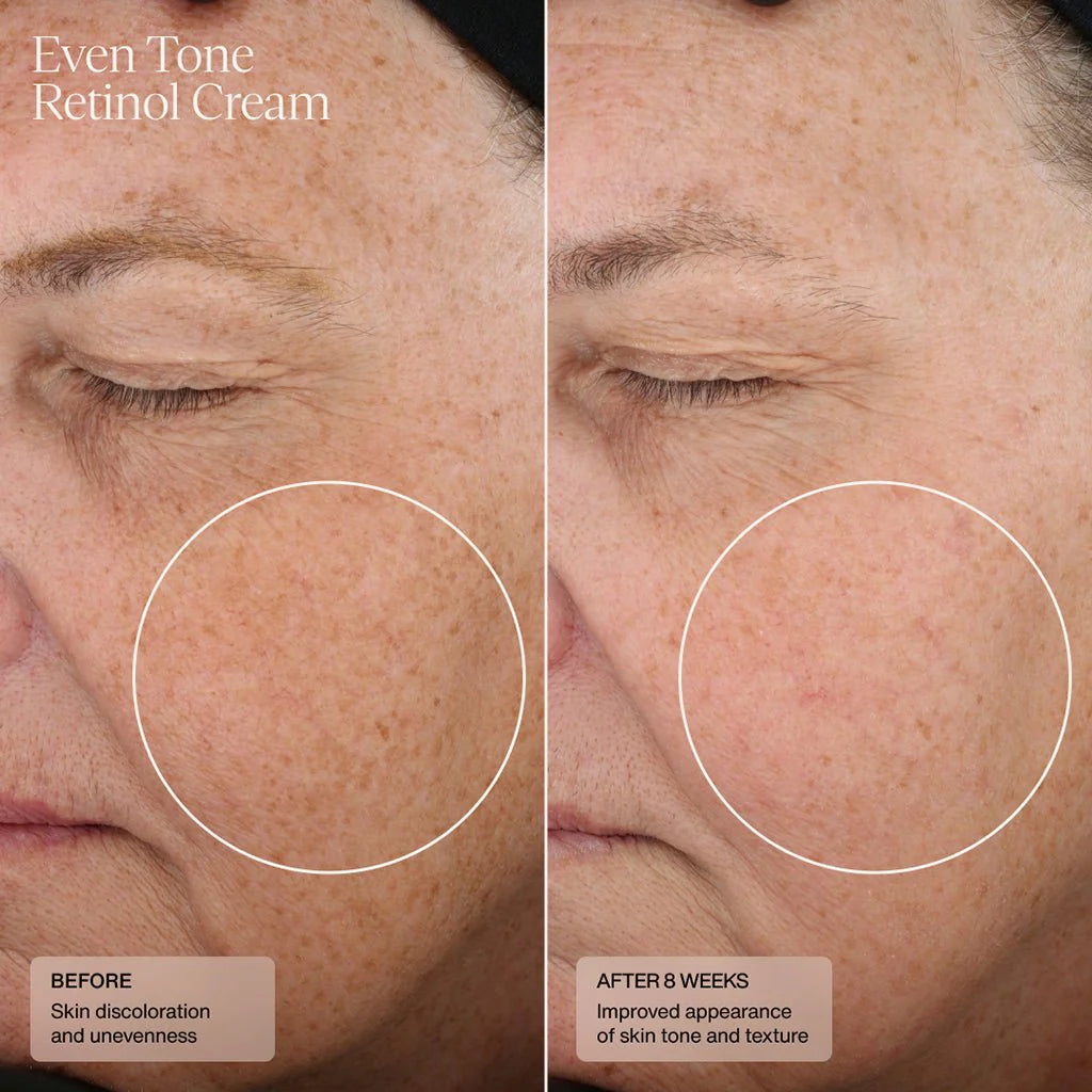 Sente Even Tone Retinol Cream