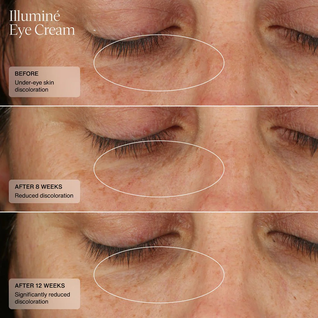Illumine Eye Cream