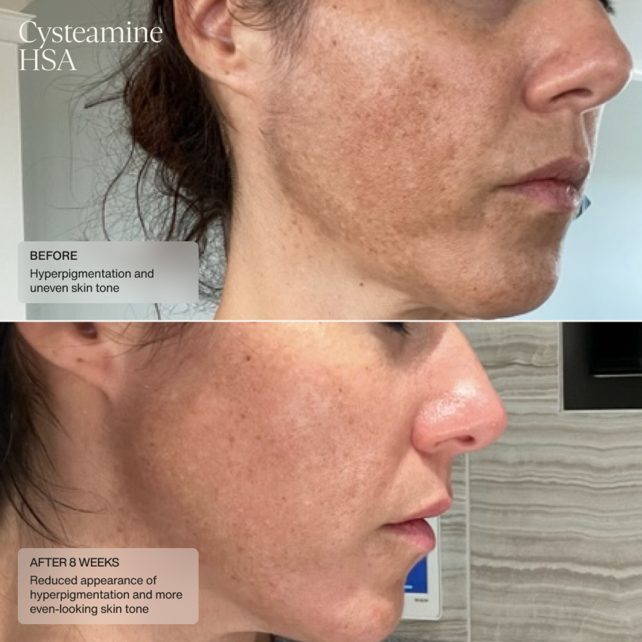 Sente Pigment and Tone Correcting Mask