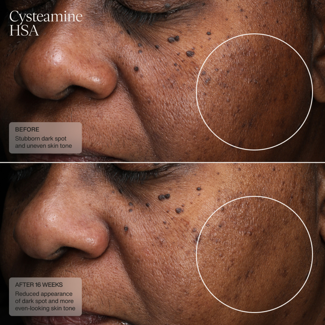 Sente Pigment and Tone Correcting Mask Clinical 2