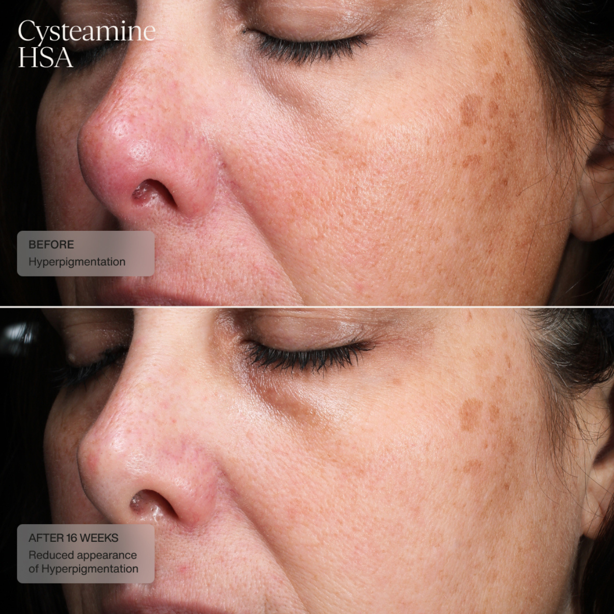 Sente Pigment and Tone Correcting Mask Clinical 3