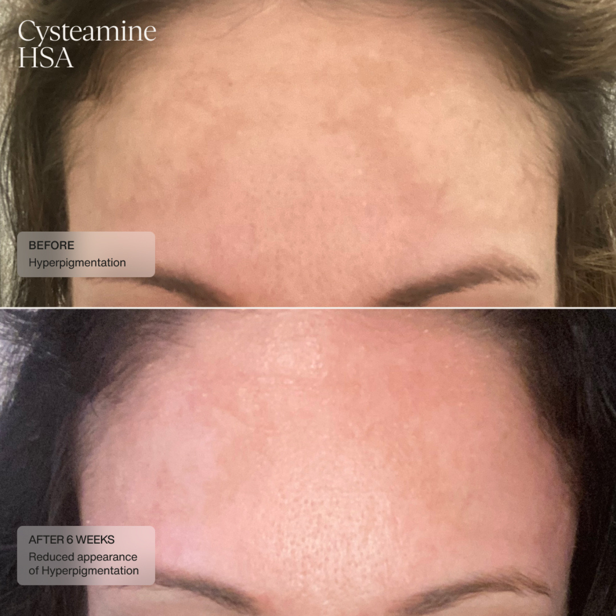 Sente Pigment and Tone Correcting Mask Clinical 4