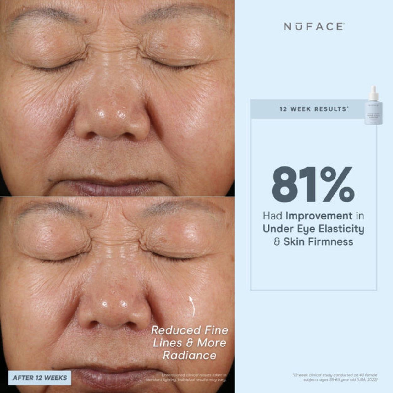 Super Vita C Booster Serum 8
