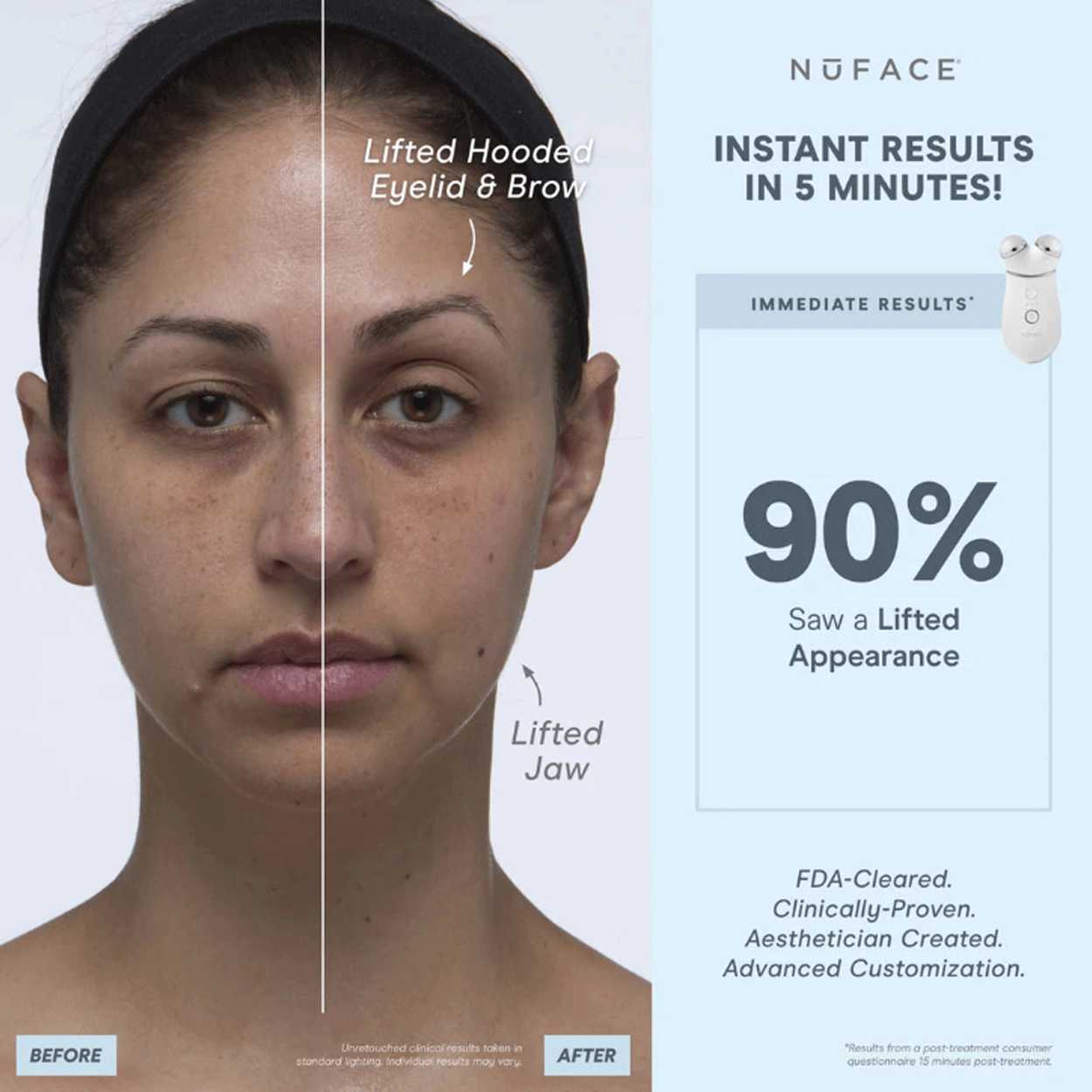 TRINITY+ Wrinkle Reducer Attachment 5