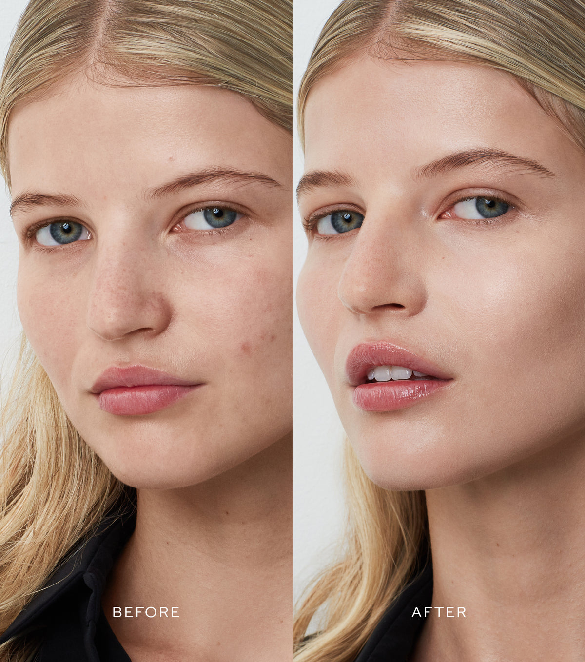 Vital Skincare Complexion Drops