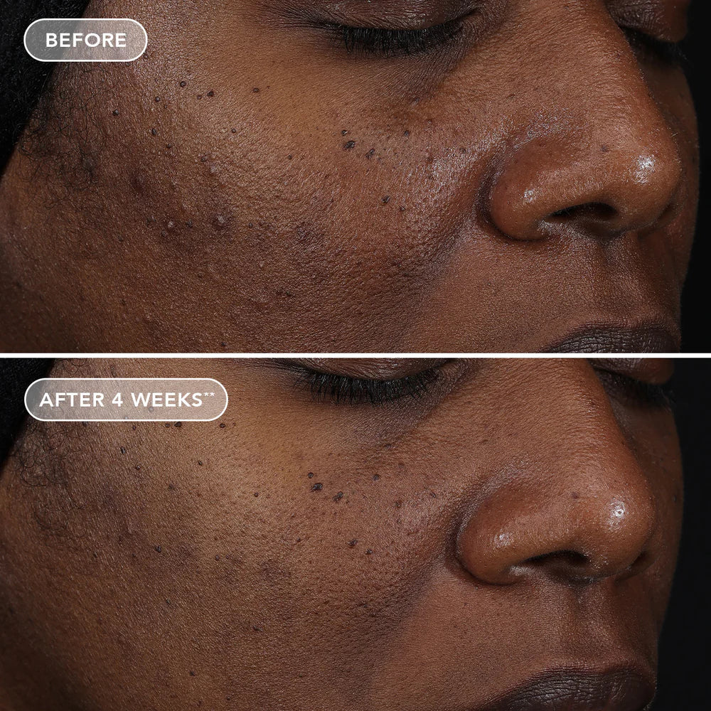 AGELESS+ retinol repair crème 0.3% retinol complex Model Image 1