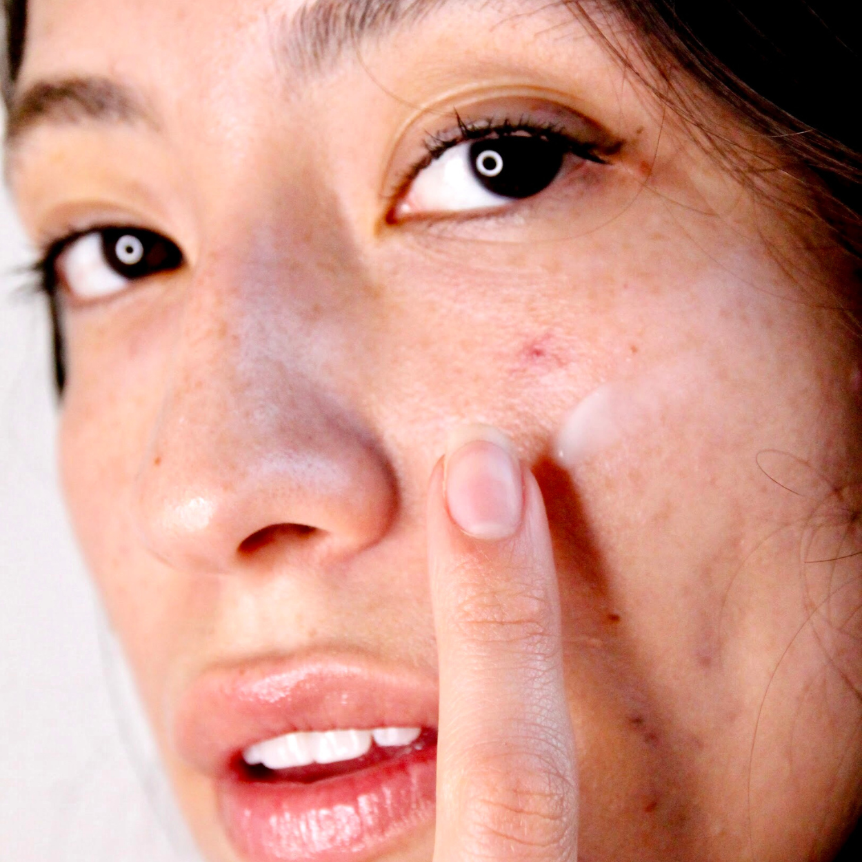 Acne Control Serum Model Image