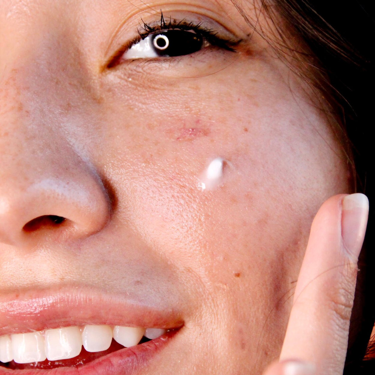 Acne Control Serum Model Image 1