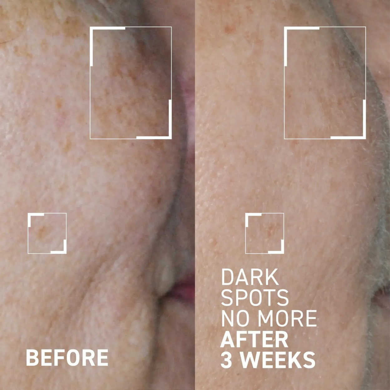 Bright This Way Dark Spots No More Triple Acid Spot Minimizing Concentrate