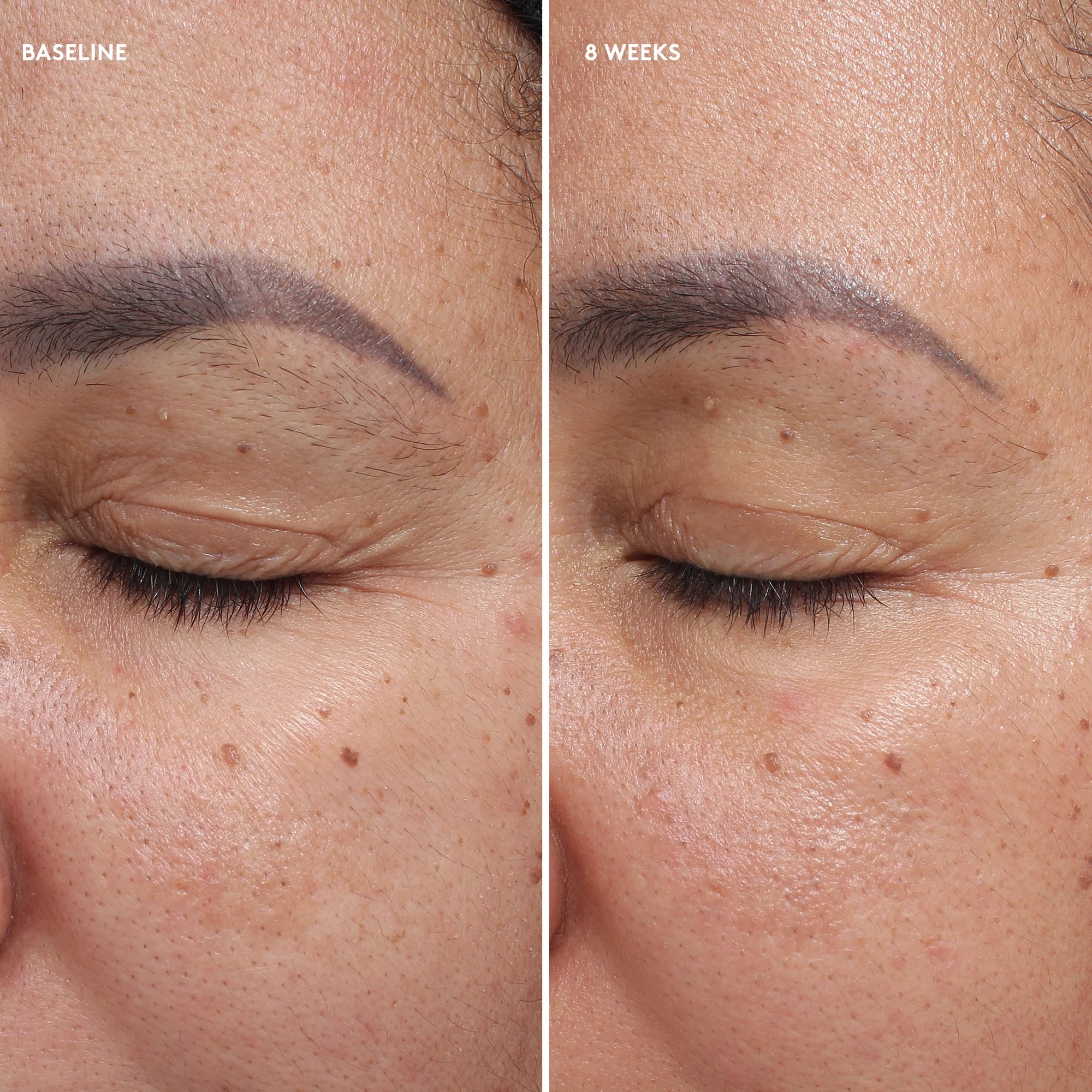 Colorescience Total Eye Firm and Repair Cream Clinical