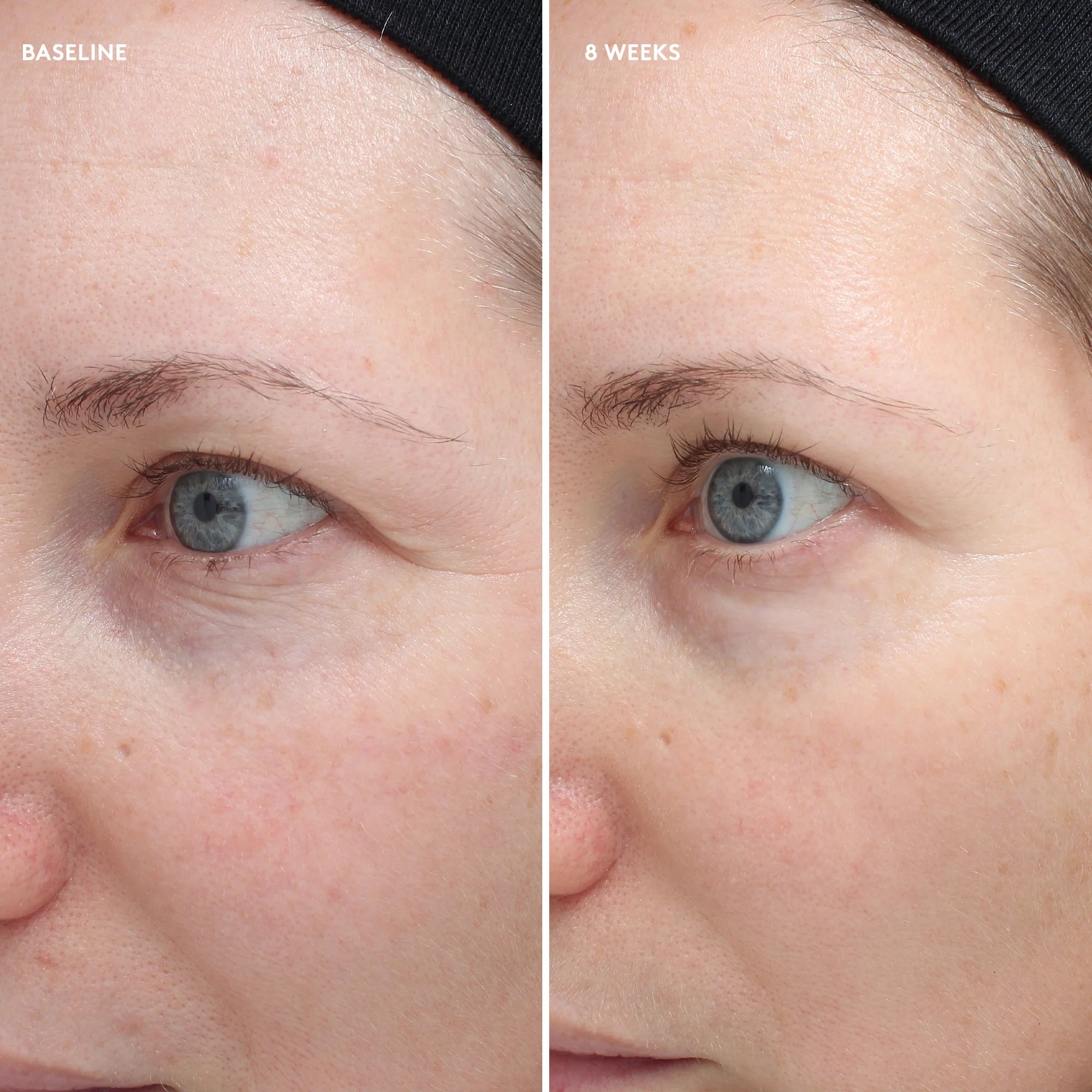 Colorescience Total Eye Firm and Repair Cream Clinical