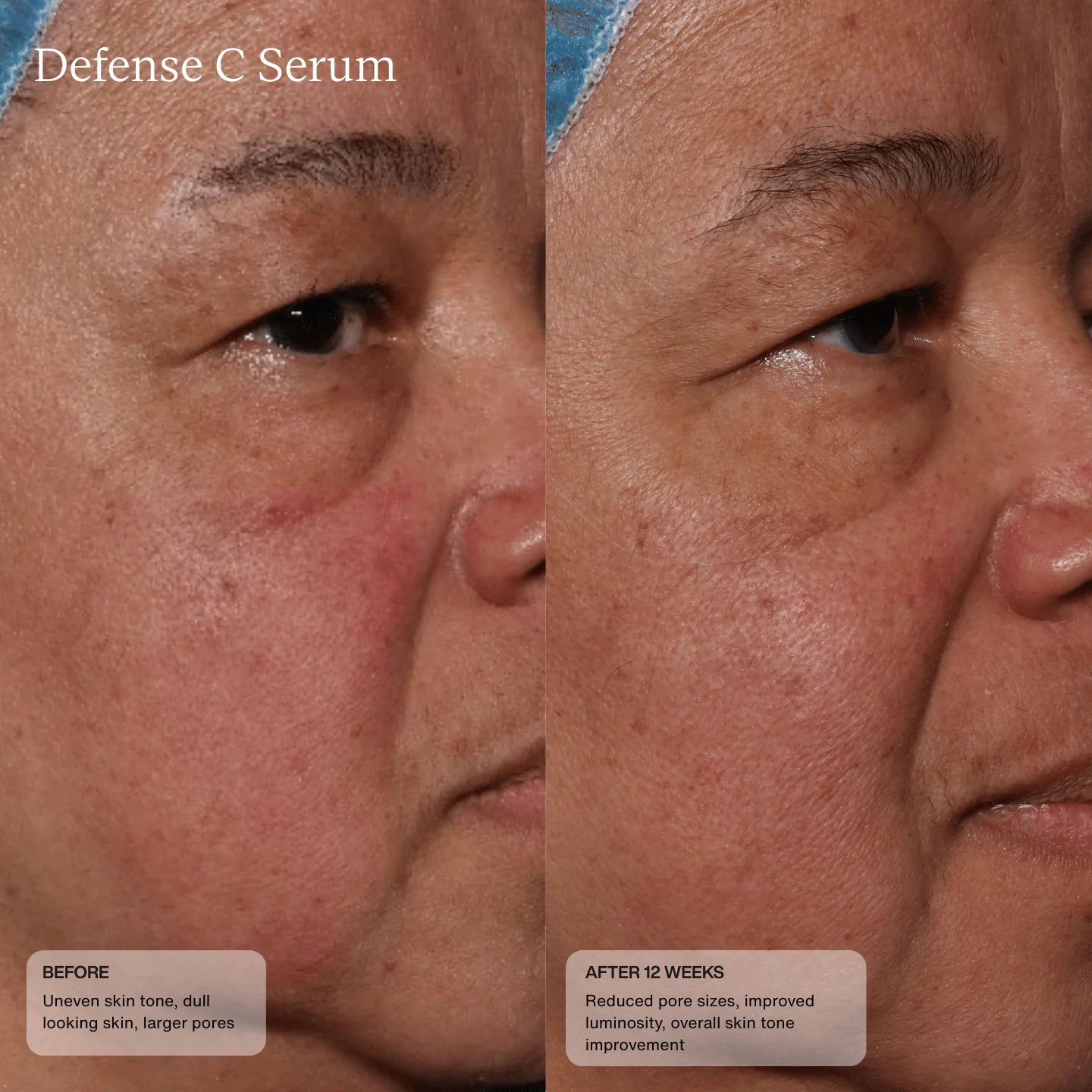 Defense C Serum Model Image