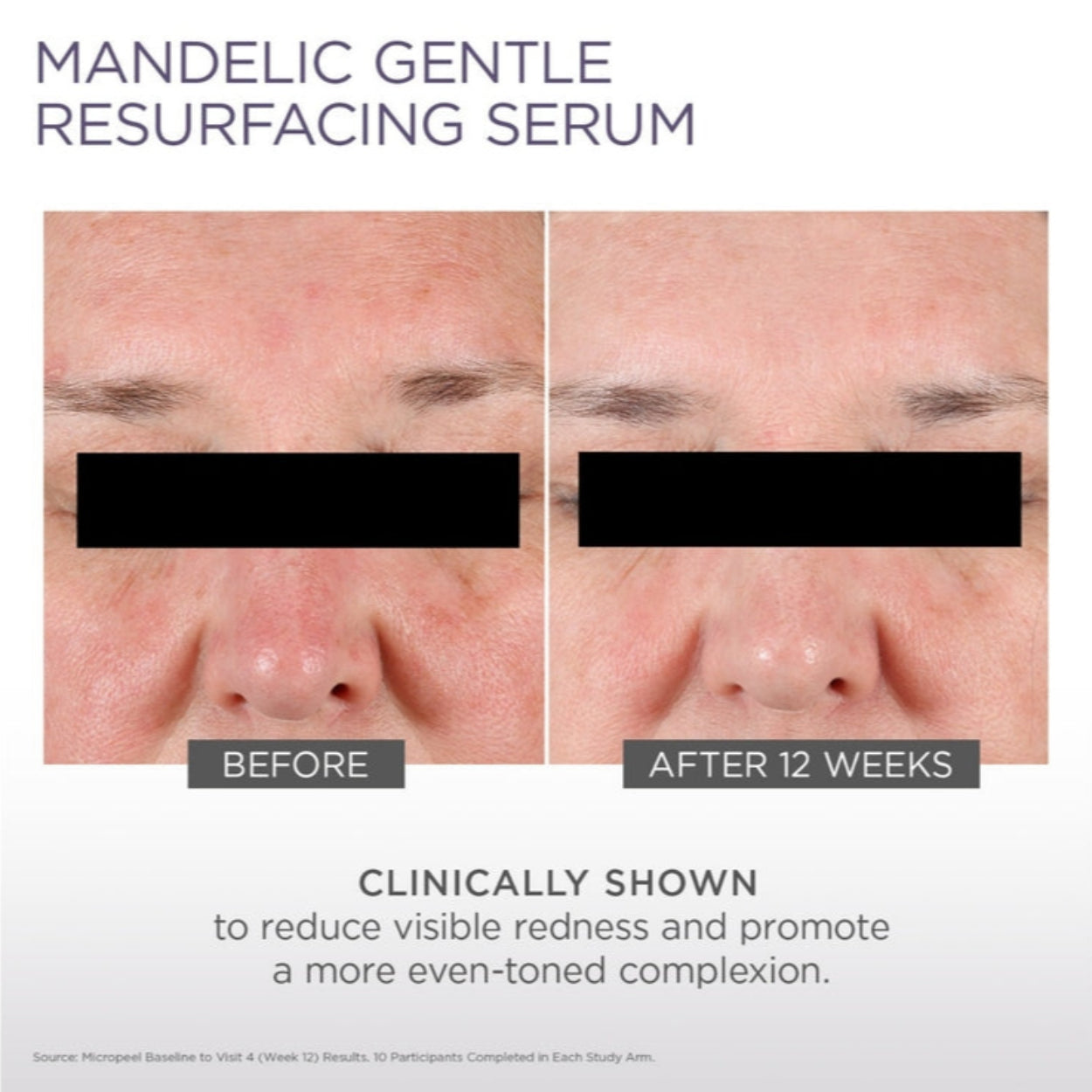 Glytone Mandelic Gentle Resurfacing Serum Image 3