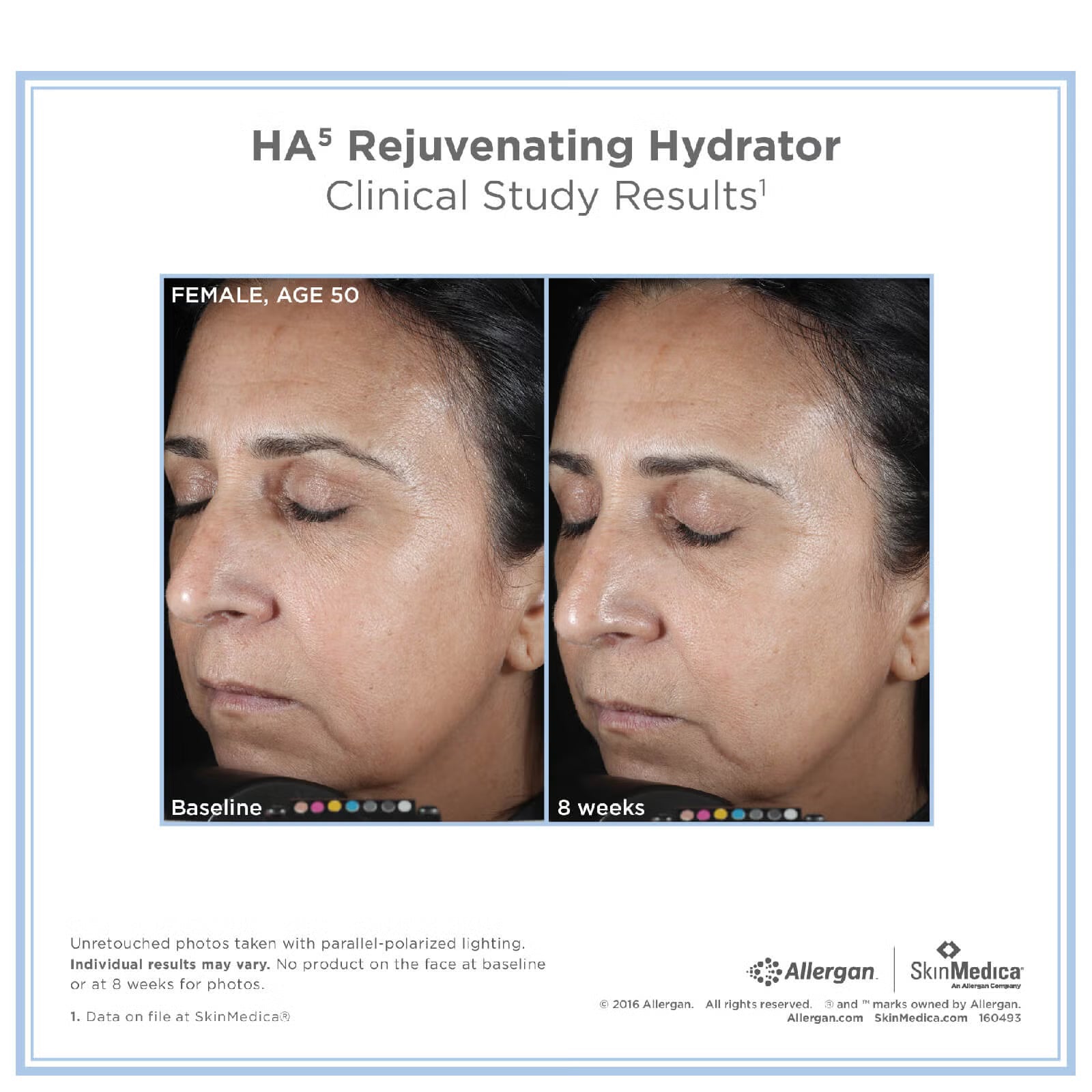 Ha5 Rejuvenating Hydrator Model Image