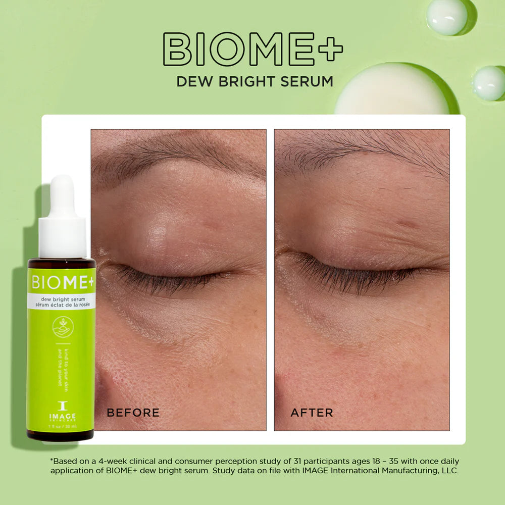 IMAGE Biome+ Dew Bright Serum Before After