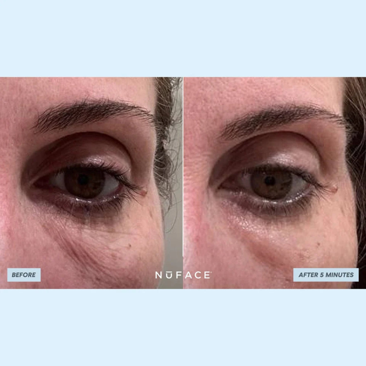 IonPlex® Hydra-Gel Power Patches Eye Masks model Image 2