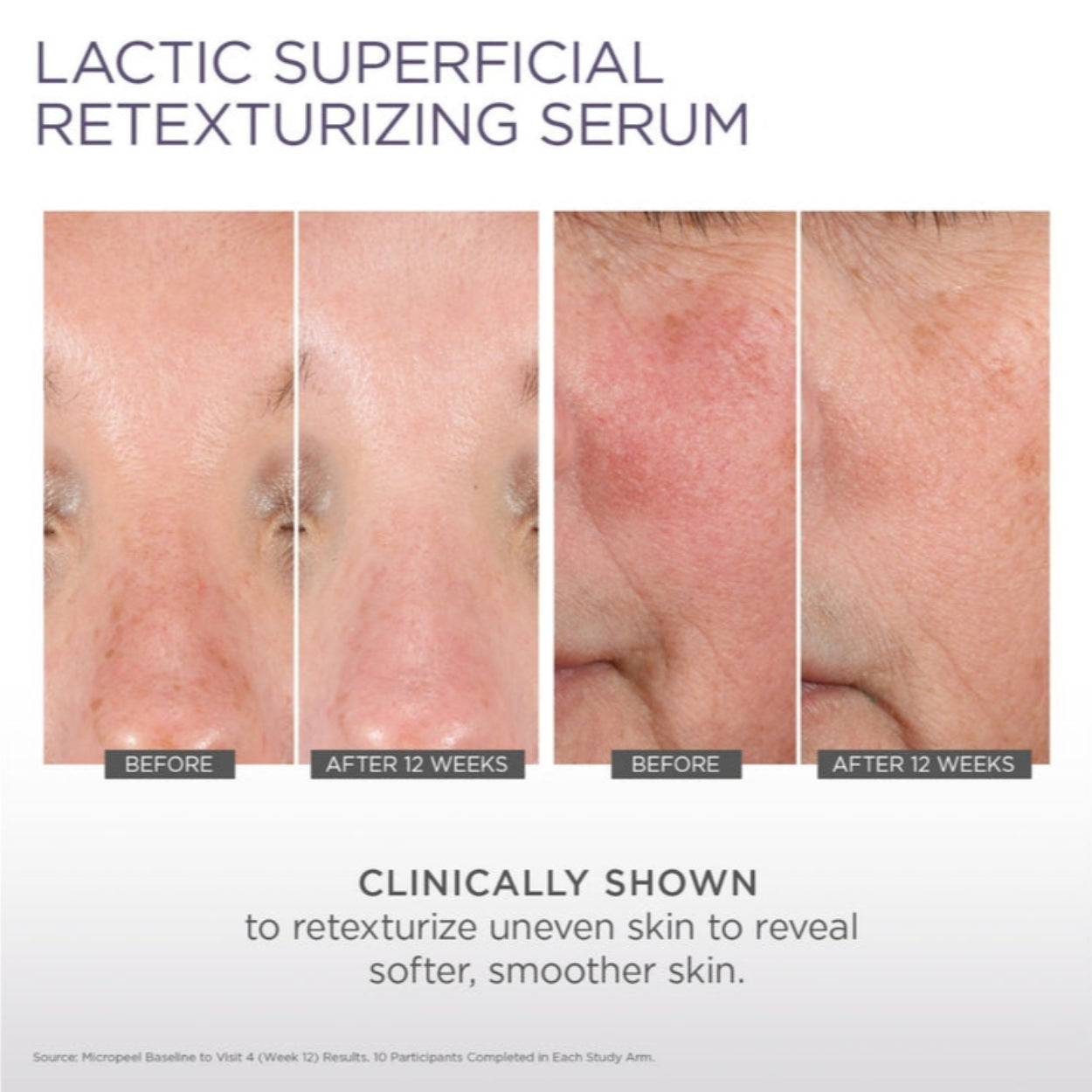 Lactic Superficial Retexturizing Serum Image 4
