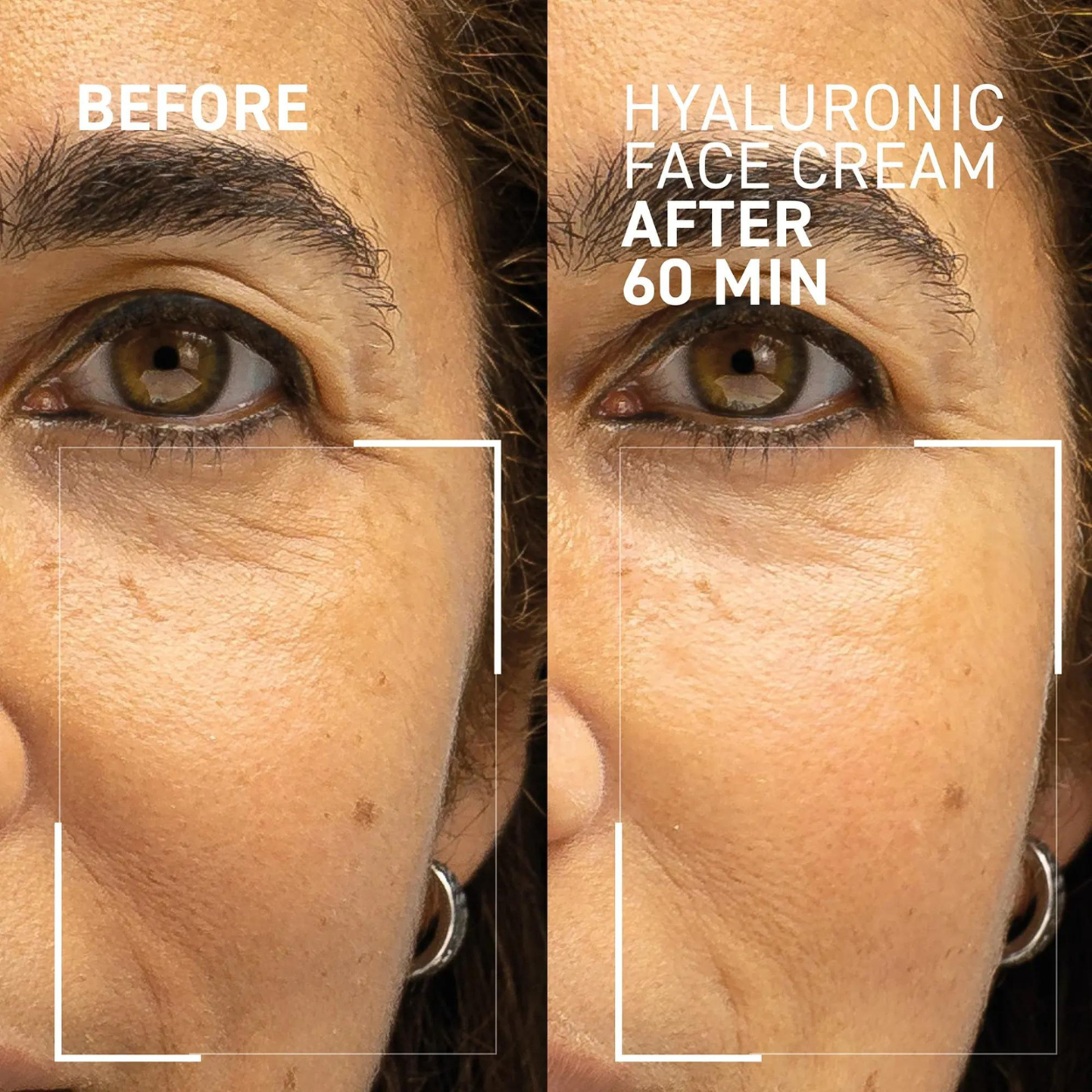 Needles No More Hyaluronic Face Cream 2.0