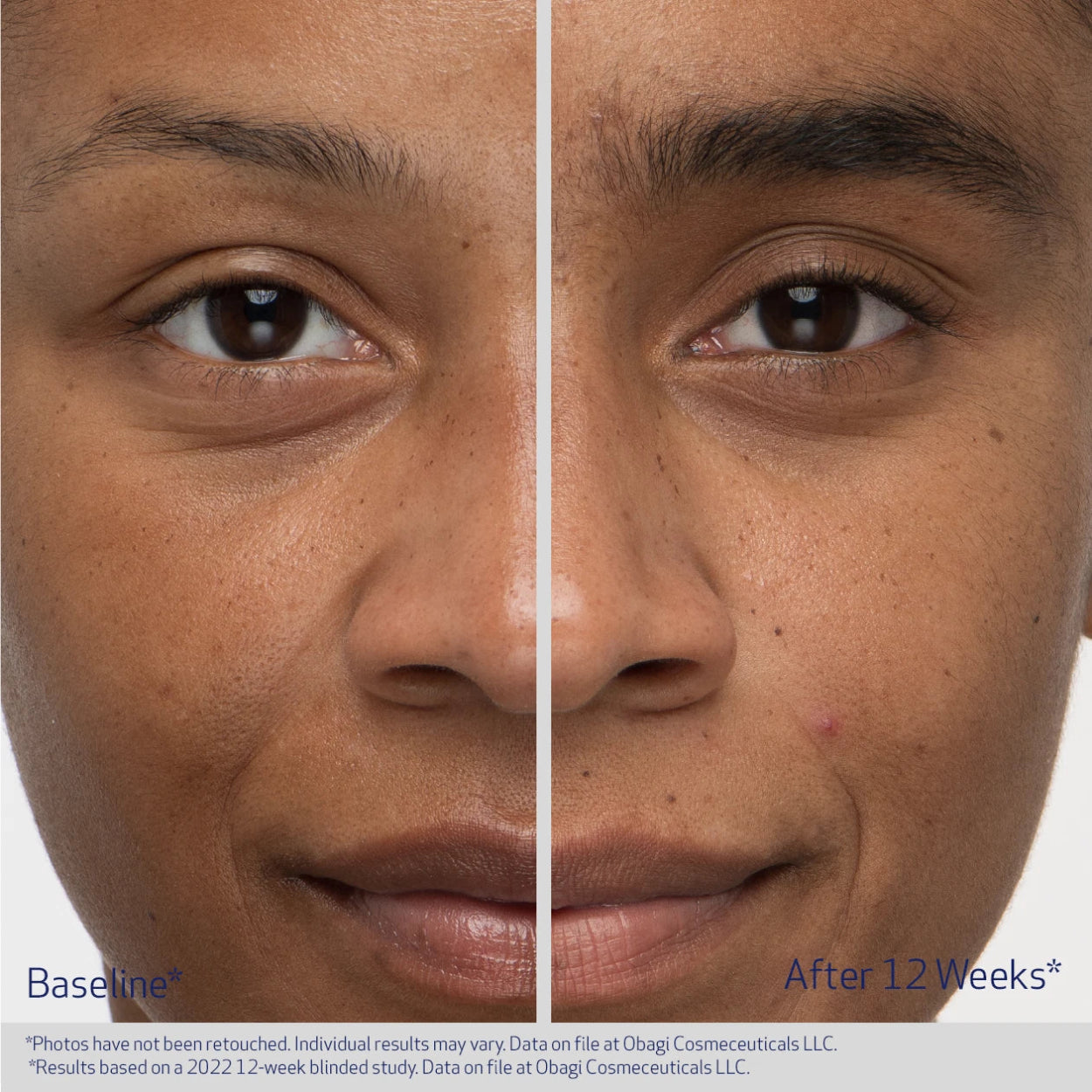 OBAGI NU-CIL® EYEBROW BOOSTING SERUM IMAGE 3