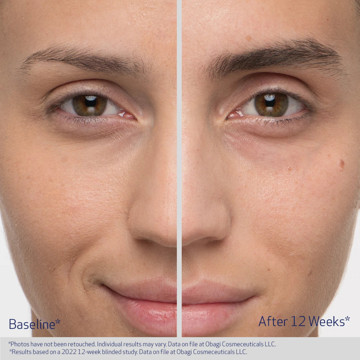 OBAGI NU-CIL® EYEBROW BOOSTING SERUM IMAGE 4