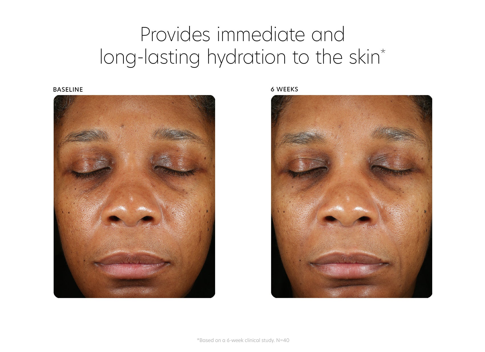 pca skin hyaluronic acid boosting serum clinical study