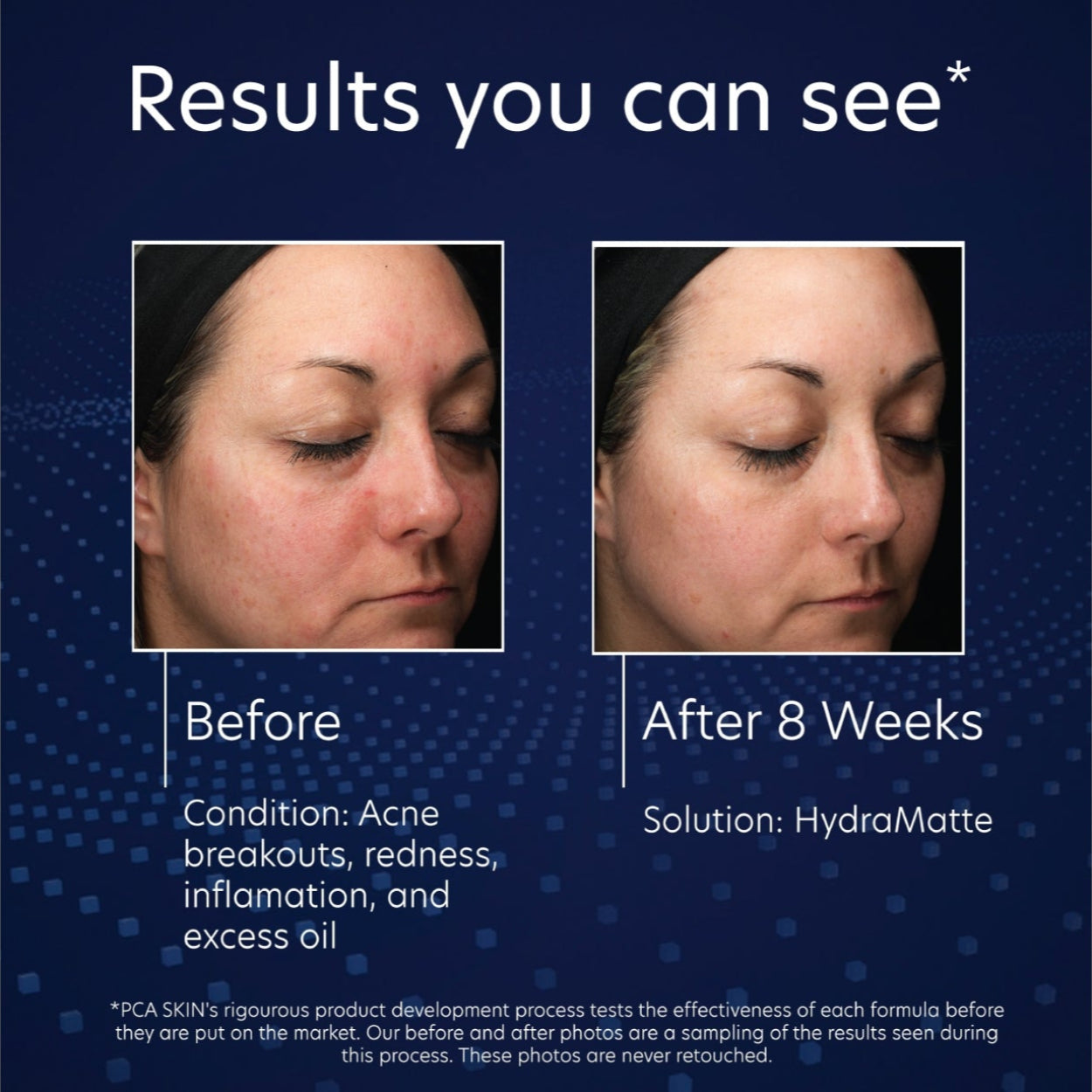 PCA Skin Hydramatte Image 6