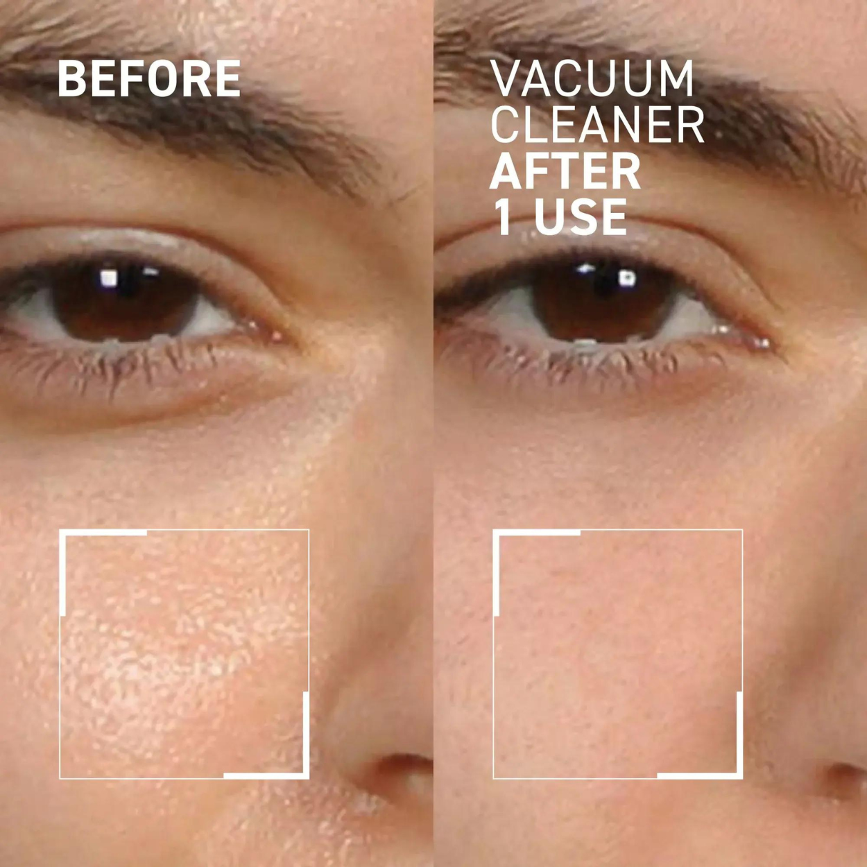 Pore No More Vacuum Cleaner Pore Purifying Mask